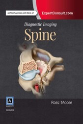 Diagnostic imaging Spine